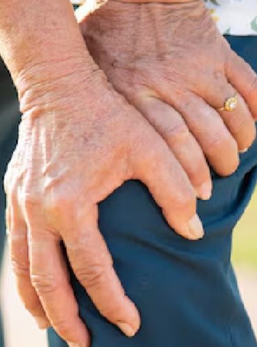 Osteoarthritis