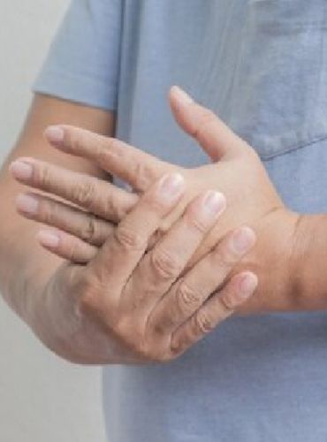 Rheumatoid Arthritis